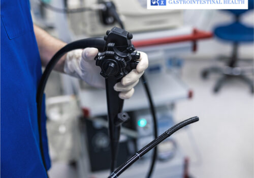 Doctor holding a colonoscopy scope in a hospital examination room before a procedure