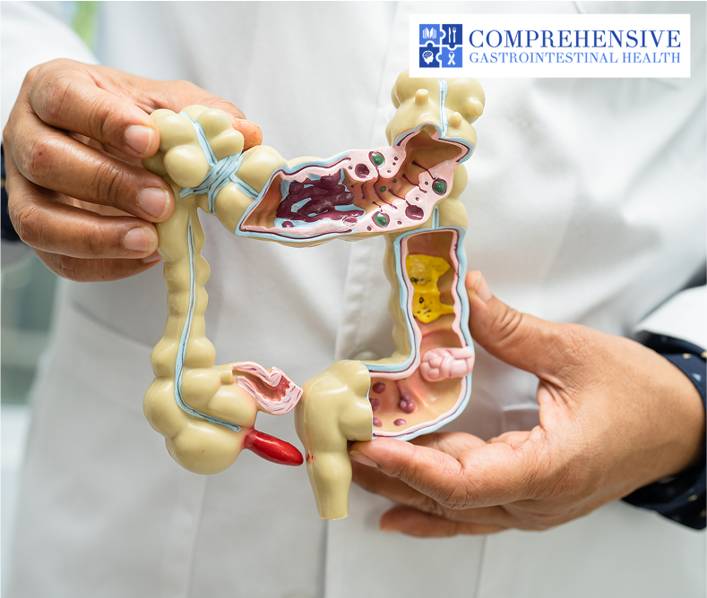 Intestine, appendix and digestive system, doctor holding anatomy model.